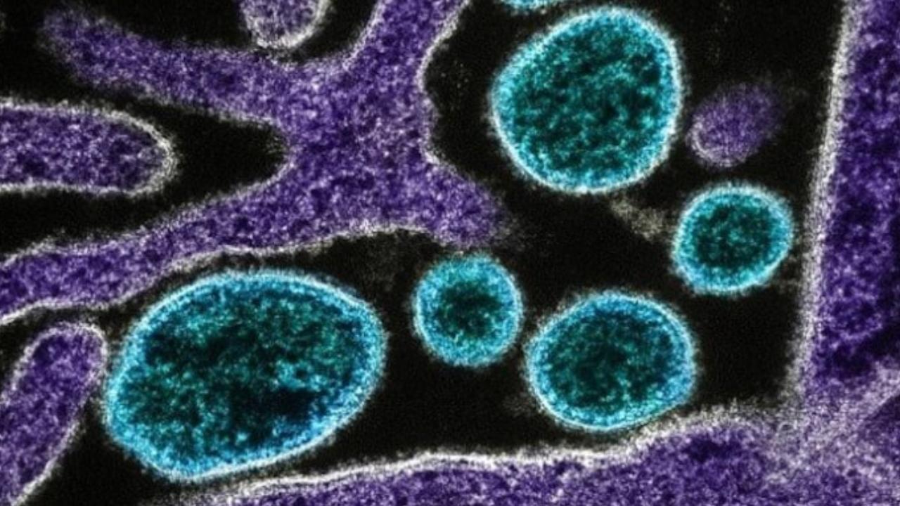 DSÖ, Atlas Okyanusu'ndaki gemide 7 hantavirüs vakası belirlendiğini bildirdi